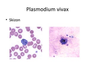 Plasmodium vivax
• Skizon
 