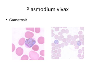 Plasmodium vivax
• Gametosit
 