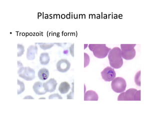 Plasmodium malariae
• Tropozoit (ring form)
 
