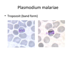 Plasmodium malariae
• Tropozoit (band form)
 