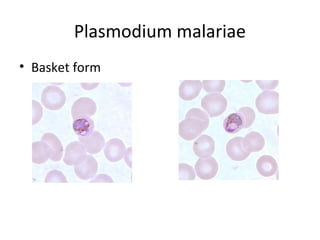 Plasmodium malariae
• Basket form
 