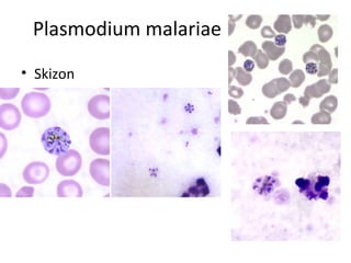 Plasmodium malariae
• Skizon
 