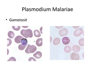 Plasmodium Malariae
• Gametosit
 
