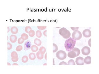 Plasmodium ovale
• Tropozoit (Schuffner’s dot)
 