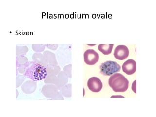 Plasmodium ovale
• Skizon
 