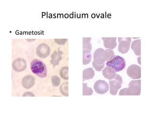 Plasmodium ovale
• Gametosit
 