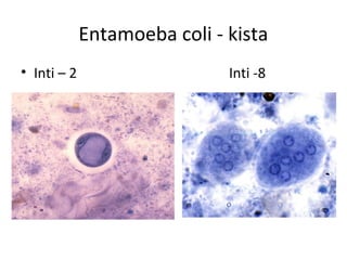 Entamoeba coli - kista
• Inti – 2                    Inti -8
 