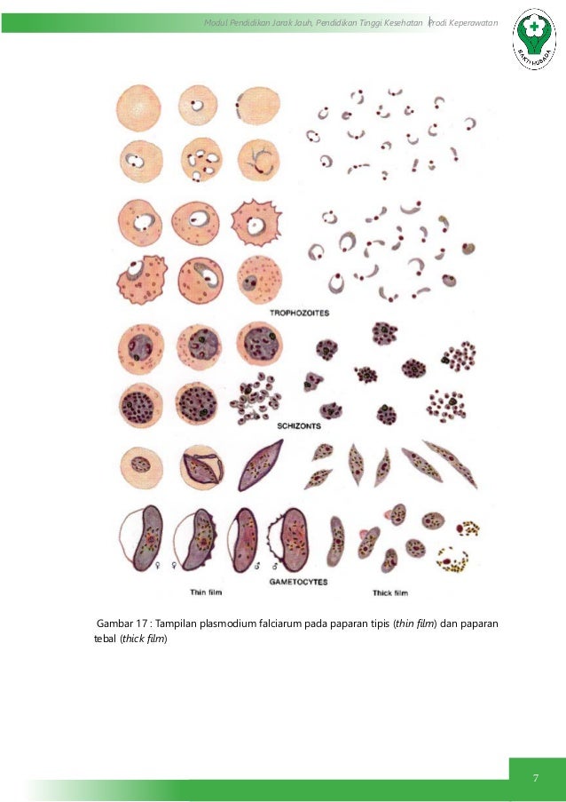 Pemeriksaan darah ( protozoa : parasit malaria)
