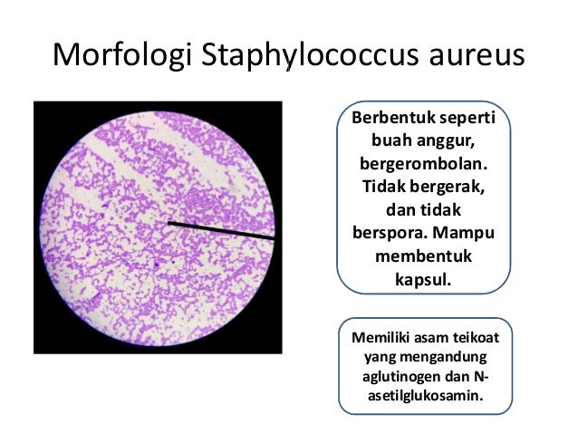Praktikum Mikrobiologi Blok 17 Sistem Muskoskeletal