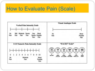 How to Evaluate Pain (Scale)
 