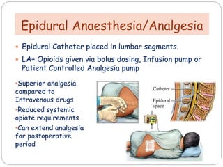 Epidural Anaesthesia/Analgesia
 Epidural Catheter placed in lumbar segments.
 LA+ Opioids given via bolus dosing, Infusion pump or
Patient Controlled Analgesia pump
•Superior analgesia
compared to
Intravenous drugs
•Reduced systemic
opiate requirements
•Can extend analgesia
for postoperative
period
 