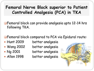 Femoral Nerve Block superior to Patient
Controlled Analgesia (PCA) in TKA
Femoral block can provide analgesia upto 12-14 hrs
following TKA.
Femoral block compared to PCA via Epidural route:
 Hunt 2009 better analgesia
 Wang 2002 better analgesia
 Ng 2001 better analgesia
 Allen 1998 better analgesia
 