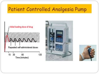 Patient Controlled Analgesia Pump
 