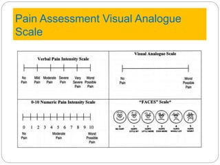 Pain Assessment Visual Analogue
Scale
 