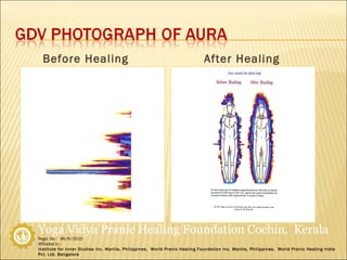 Before Healing After Healing 