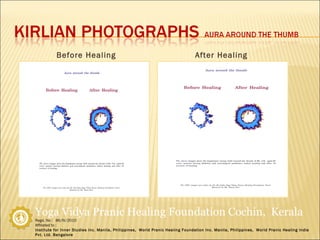 Before Healing After Healing 