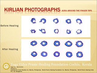 Before Healing After Healing 