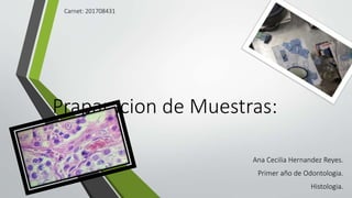 Praparacion de Muestras:
Ana Cecilia Hernandez Reyes.
Primer año de Odontologia.
Histologia.
Carnet: 201708431
 