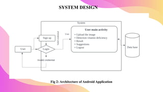 Vitamin Deficiency Detection Using Image Processing and Neural Network ...