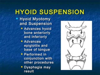 HYOID SUSPENSIONHYOID SUSPENSION
 Hyoid MyotomyHyoid Myotomy
and Suspensionand Suspension
 Advances hyoidAdvances hyoid
bone anteriorlybone anteriorly
and inferiorlyand inferiorly
 AdvancesAdvances
epiglottis andepiglottis and
base of tonguebase of tongue
 Performed inPerformed in
conjunction withconjunction with
other proceduresother procedures
 Dysphagia mayDysphagia may
resultresult
 