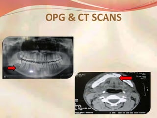 OPG & CT SCANS
 