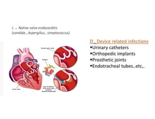 C . Native valve endocarditis
(candida , Aspergillus , streptococcus)
D . Device related infections
Urinary catheters
Orthopedic implants
Prosthetic joints
Endotracheal tubes..etc,.
 