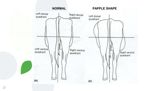 22
NORMAL PAPPLE SHAPE
 