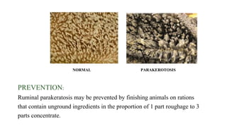 32
PREVENTION:
Ruminal parakeratosis may be prevented by finishing animals on rations
that contain unground ingredients in the proportion of 1 part roughage to 3
parts concentrate.
NORMAL PARAKEROTOSIS
 