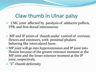 Claw thumb in Ulnar palsy
 CMC joint affected by paralysis of adductor pollicis,
FPB, and first dorsal interosseous
 MP and IP joints of thumb under control of extrinsic
flexors and extensors, with proximal phalanx
behaving like intercalated bone.
MP joint will go into hyperextension and IP joint into
flexion because of the greater extensor moment at the
MP joint and the lesser extensor moment at the IP
joint, respectively.
 “Z”-thumb deformity
 