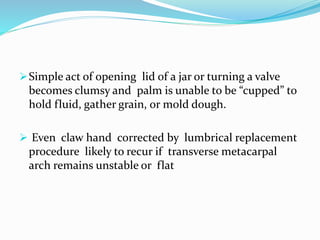 Simple act of opening lid of a jar or turning a valve
becomes clumsy and palm is unable to be “cupped” to
hold fluid, gather grain, or mold dough.
 Even claw hand corrected by lumbrical replacement
procedure likely to recur if transverse metacarpal
arch remains unstable or flat
 