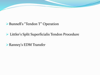 Bunnell's “Tendon T” Operation
 Littler's Split Superficialis Tendon Procedure
Ranney's EDM Transfer
 