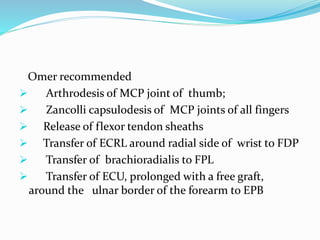 Omer recommended
 Arthrodesis of MCP joint of thumb;
 Zancolli capsulodesis of MCP joints of all fingers
 Release of flexor tendon sheaths
 Transfer of ECRL around radial side of wrist to FDP
 Transfer of brachioradialis to FPL
 Transfer of ECU, prolonged with a free graft,
around the ulnar border of the forearm to EPB
 