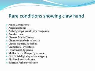 Rare conditions showing claw hand
 Ampola syndrome
 Angiokeratoma
 Arthrogyropsis multiplex congenita
 Aural atresia
 Charcot Marie Disease
 Chondrodysplasia punctata
 Chromosomal anomalies
 Craniofacial dysostosis
 Frontonasal dysplasia
 Muller Barth Menger Syndrome
 Oro facial digital syndrome type 4
 Pitt Hopkins syndrome
 Stratton Parker syndrome
 