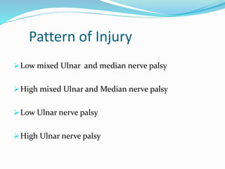 Pattern of Injury
Low mixed Ulnar and median nerve palsy
High mixed Ulnar and Median nerve palsy
Low Ulnar nerve palsy
High Ulnar nerve palsy
 