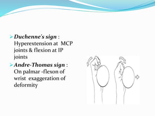 Duchenne's sign :
Hyperextension at MCP
joints & flexion at IP
joints
Andre-Thomas sign :
On palmar -flexon of
wrist exaggeration of
deformity
 