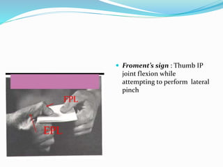 FPL
EPL
 Froment’s sign : Thumb IP
joint flexion while
attempting to perform lateral
pinch
 