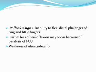  Pollock's sign : Inability to flex distal phalanges of
ring and little fingers
 Partial loss of wrist flexion may occur because of
paralysis of FCU
Weakness of ulnar side grip
 