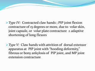 Type IV: Contracted claw hands ; PIP joint flexion
contracture of 15 degrees or more, due to volar skin,
joint capsule, or volar plate contracture ± adaptive
shortening of long flexors
Type V: Claw hands with attrition of dorsal extensor
apparatus at PIP joint with “hooding deformity,”
fibrous or bony ankylosis of PIP joint, and MP joint
extension contracture
 