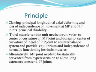 Principle
Clawing principal longitudinal axial deformity and
loss of independence of movement at MP and PIP
joints principal disability
 Third muscle-tendon unit needs to run volar to
center of curvature of MP joint and dorsal to center of
curvature of head of PIP joint to counterbalance
system and provide equilibrium and independence of
normally functioning intrinsic muscles
Alternatively, MP joint needs to be statically
prevented from hyperextension to allow long
extensors to extend IP joints
 