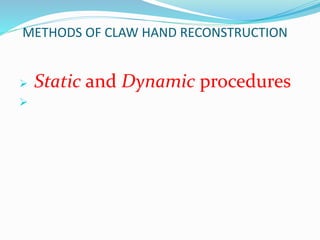 METHODS OF CLAW HAND RECONSTRUCTION
 Static and Dynamic procedures

 