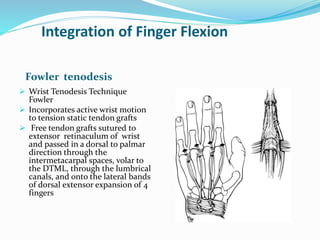 Integration of Finger Flexion
Fowler tenodesis
 Wrist Tenodesis Technique
Fowler
 Incorporates active wrist motion
to tension static tendon grafts
 Free tendon grafts sutured to
extensor retinaculum of wrist
and passed in a dorsal to palmar
direction through the
intermetacarpal spaces, volar to
the DTML, through the lumbrical
canals, and onto the lateral bands
of dorsal extensor expansion of 4
fingers
 