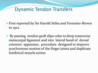 Dynamic Tendon Transfers
First reported by Sir Harold Stiles and Forrester-Brown
in 1922
 By passing tendon graft slips volar to deep transverse
metacarpal ligament and into lateral band of dorsal
extensor apparatus, procedure designed to improve
synchronous motion of the finger joints and duplicate
lumbrical muscle action
 