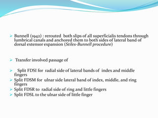  Bunnell (1942) : rerouted both slips of all superficialis tendons through
lumbrical canals and anchored them to both sides of lateral band of
dorsal extensor expansion (Stiles-Bunnell procedure)
 Transfer involved passage of
 Split FDSI for radial side of lateral bands of index and middle
fingers
 Split FDSM for ulnar side lateral band of index, middle, and ring
fingers
 Split FDSR to radial side of ring and little fingers
 Split FDSL to the ulnar side of little finger
 
