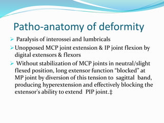 Patho-anatomy of deformity
 Paralysis of interossei and lumbricals
Unopposed MCP joint extension & IP joint flexion by
digital extensors & flexors
 Without stabilization of MCP joints in neutral/slight
flexed position, long extensor function “blocked” at
MP joint by diversion of this tension to sagittal band,
producing hyperextension and effectively blocking the
extensor's ability to extend PIP joint.‡
 