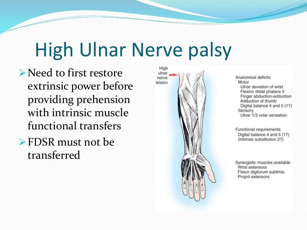 management of claw hand
