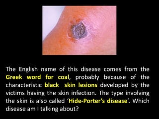 The English name of this disease comes from the
Greek word for coal, probably because of the
characteristic black skin lesions developed by the
victims having the skin infection. The type involving
the skin is also called ‘Hide-Porter’s disease’. Which
disease am I talking about?
 