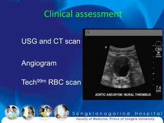 Clinical assessment

USG and CT scan

Angiogram

Tech99m RBC scan
 