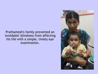Prathamesh's family prevented an
'avoidable' blindness from affecting
his life with a simple, timely eye
examination.
 