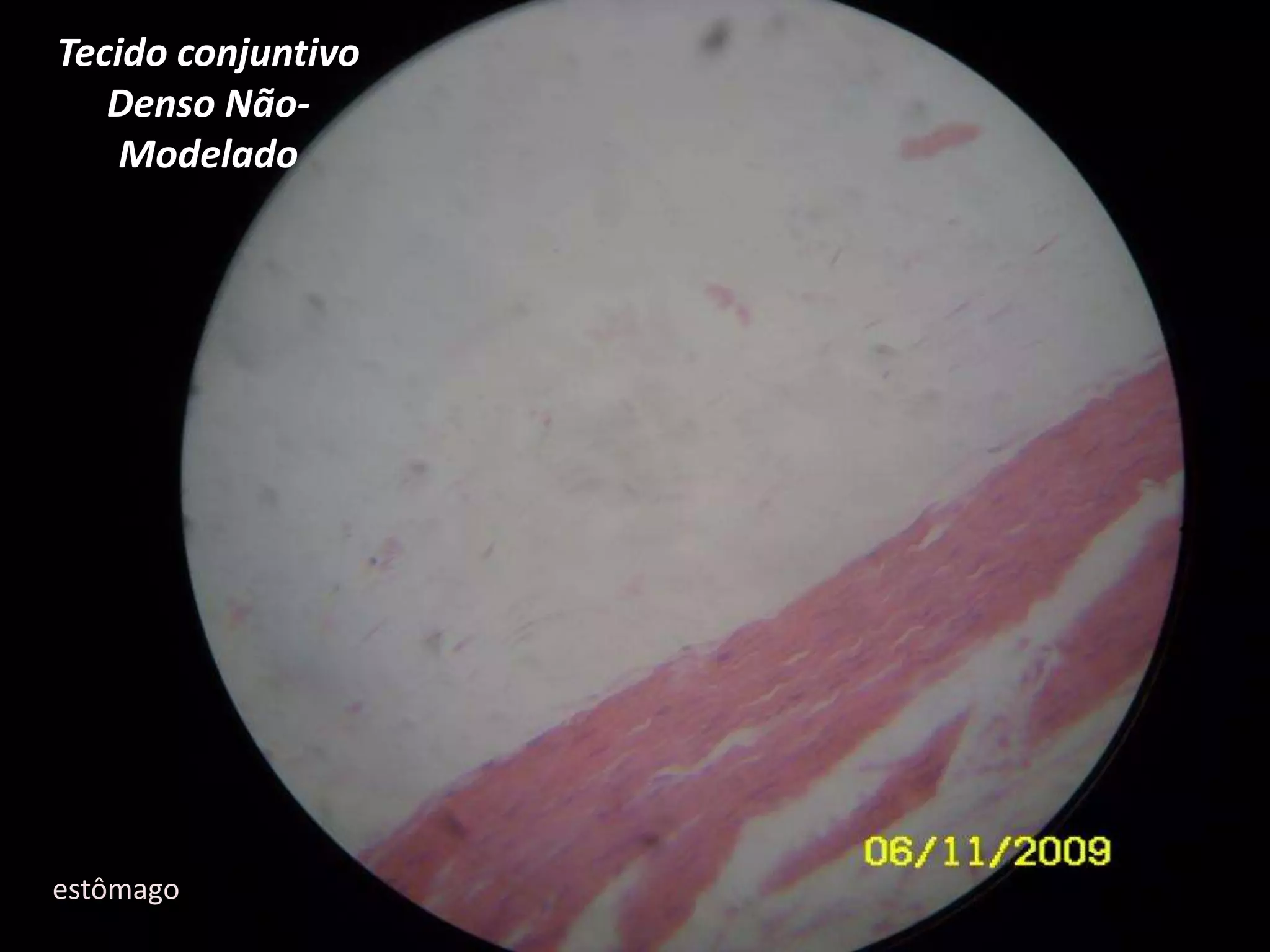 Tecido conjuntivo Denso Não-Modeladoestômago