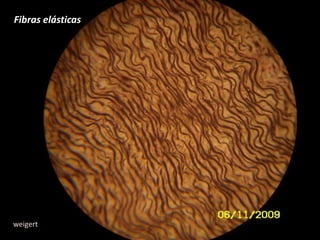 Fibras elásticasweigert